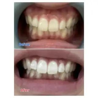 M渋谷店所属・M渋谷 ホワイトニングのエステ・リラクイメージ