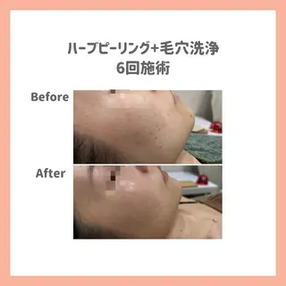 ハーブピーリング専門 muro.のエステ・リラクイメージ