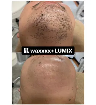 Epina 千葉店 【エピナ】のエステ・リラクイメージ