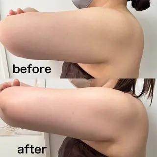 Miiju.所属・Miiju. 石巻市 脂肪冷却  鈴木のエステ・リラクイメージ