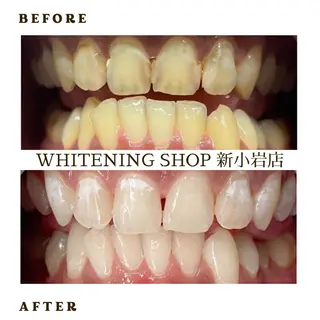 メンズ ホワイトニング ショップ新小岩店のその他イメージ