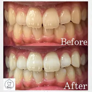 Blanco川口駅前店所属・Blanco 川口駅前店のその他イメージ