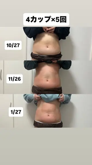 Miiju.所属・Miiju. 石巻市 脂肪冷却  鈴木のエステ・リラクイメージ