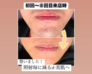 メンズ メンズ脱毛サロン Le falcoのエステ・リラクイメージ