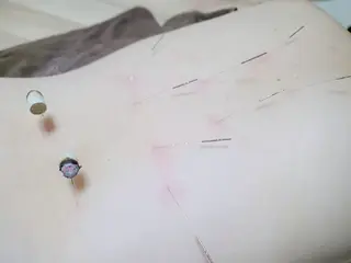 温活×自律神経 鍼灸Amaterasのエステ・リラクイメージ