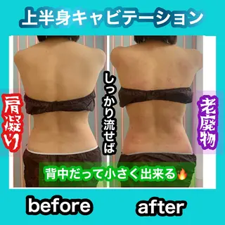 痩身/脱毛/ネイル HARUKAのエステ・リラクイメージ