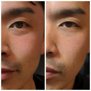 結果が出るスキンケア 肌質改善/まつパのエステ・リラクイメージ