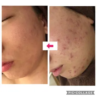 ミディアム カラー パーマ ヘアアレンジ メンズ キッズ ネイル マツエク・マツパ 四つ星サロン🎖 腸＆ニキビケアに特化のエステ・リラクイメージ