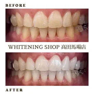 メンズ ホワイトニング ショップ高田馬場店のその他イメージ