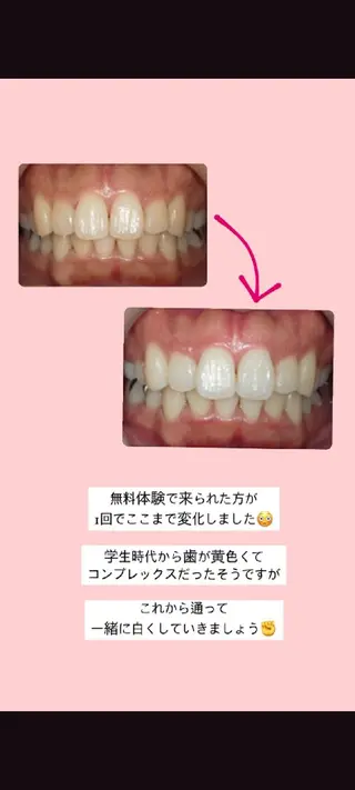 セルフホワイトニングサロン エクシア江坂店所属・セルフホワイトニング エクシア江坂店のエステ・リラクイメージ