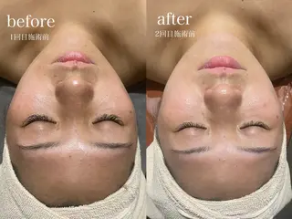 サロン・ド・ポラリス所属・サロンド ポラリスのエステ・リラクイメージ