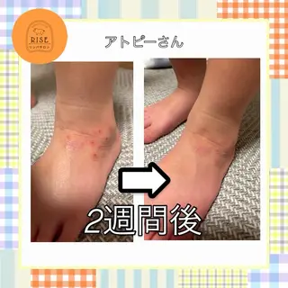 リンパサロン RISE🐷(リセ)のエステ・リラクイメージ