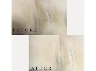 Its Yoshikaのエステ・リラクイメージ