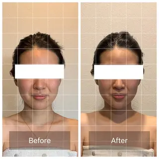 Eminy. HITOMIのエステ・リラクイメージ