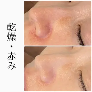 ハーブピーリング専門 BIOEL横浜のエステ・リラクイメージ