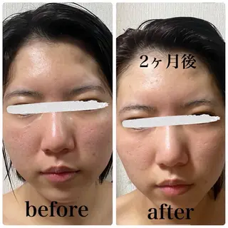 アピタ千代田橋店 POLA THE BEAUTY所属・エステ ツヤ肌 マッサージ POLAのエステ・リラクイメージ