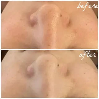 メンズ メナード岐阜市茜部 杉浦のエステ・リラクイメージ