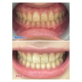 M渋谷店所属・Ｍ渋谷 ホワイトニングのエステ・リラクイメージ