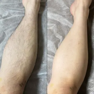 六本木脱毛andS 店長Sachiのエステ・リラクイメージ