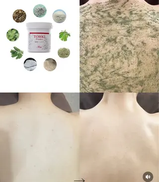 ハーブピーリング/韓国肌管理/フェイシャル/毛穴洗浄/眉毛/顔脱毛【糸脱毛専門】rev所属・ハーブピーリング🌹 毛穴洗浄❤️眉waxのエステ・リラクイメージ