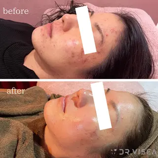 Beauty   Salon  Adiy所属・Adiy ikumiのエステ・リラクイメージ