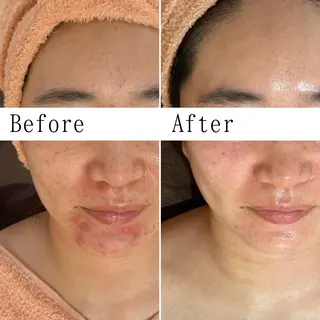 BEAUTY SALON　Lilyのエステ・リラクイメージ