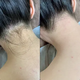 六本木脱毛andS 店長Sachiのエステ・リラクイメージ