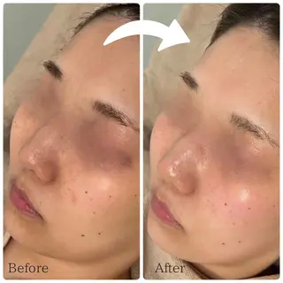 MiMiy 銀座店のエステ・リラクイメージ