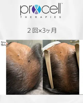 Salon Bebe名古屋所属・Salon Bebe 名古屋のエステ・リラクイメージ