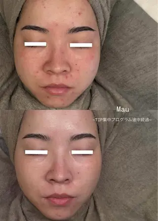 Mau beauty salon所属・Mau (マウ)のエステ・リラクイメージ