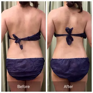 美腸×筋膜🌿 ウェルネスラボ星ヶ丘のエステ・リラクイメージ