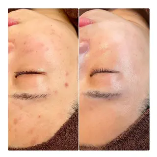 湘南エステサロン moaのエステ・リラクイメージ