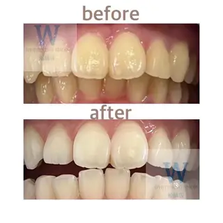 ホワイトニング ショップ船橋店🦷のエステ・リラクイメージ