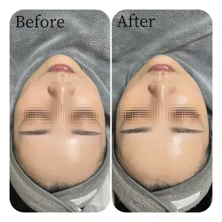 Éclat de Belle🫧白玉肌のエステ・リラクイメージ