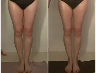 BELLEFINE 💕痩身・小顔・脱毛のエステ・リラクイメージ