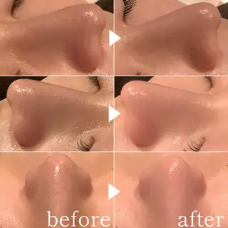 脱毛&エステサロン JIGGLY武蔵小山のエステ・リラクイメージ