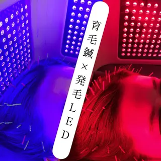 小顔美容鍼専門サロン 渋谷YZのエステ・リラクイメージ