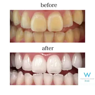 メンズ キッズ ホワイトニングショップ町田店所属・ホワイトニング ショップ町田店のその他イメージ