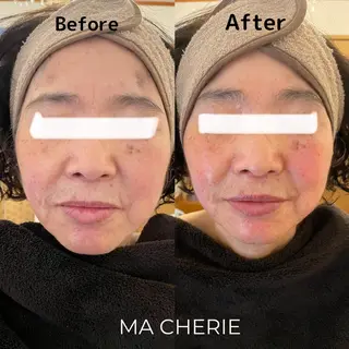 MA CHÉRIE所属・体質別痩身&小顔 MA CHÉRIEのエステ・リラクイメージ