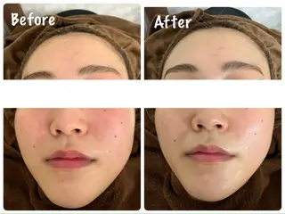 KalanDiva〜 ｶﾗﾝﾃﾞｨｰﾊﾞ〜のエステ・リラクイメージ