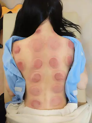 お顔のむくみたるみ 専門☆美容鍼小顔矯正のエステ・リラクイメージ