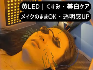 小顔美容鍼専門サロン 渋谷YZのエステ・リラクイメージ