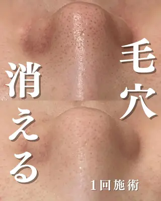 触れたくなる モテ肌へ...❤︎のエステ・リラクイメージ