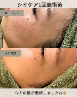 シミ毛穴|眉Wax THE flowのエステ・リラクイメージ