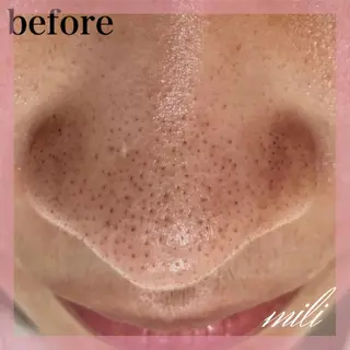 【毛穴ケア専門店✨】 mili 須藤歩華のエステ・リラクイメージ