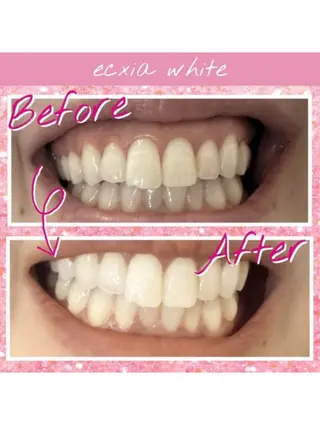 セルフホワイトニング　エクシア中野駅北口店所属・セルフホワイトニング エクシア中野駅北口店のその他イメージ