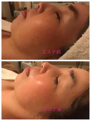 エステサロン endearのエステ・リラクイメージ