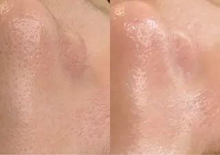 abbellina×UNO出雲塩冶店《ウノ》所属・フェイシャルエステ 🫧琉衣のエステ・リラクイメージ