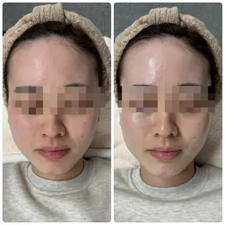 脱毛&フェイシャル 専門店muro.のエステ・リラクイメージ