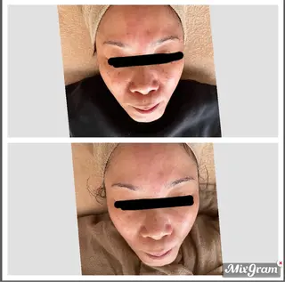 ECXIA ｴｸｼｱのエステ・リラクイメージ